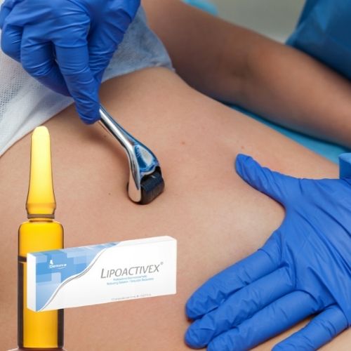 Mano de profesional de la estética haciendo tratamiento  con un aparato.