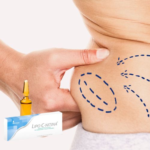 Líneas trazadas sobre cuerpo de mujer indicando exceso de grasa corporal y caja de ámpulas de LIPO C-NITINA