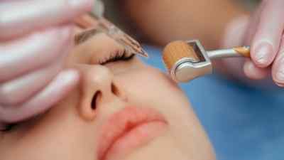 Mujer recibiendo tratamiento de mesoterapia facial.
