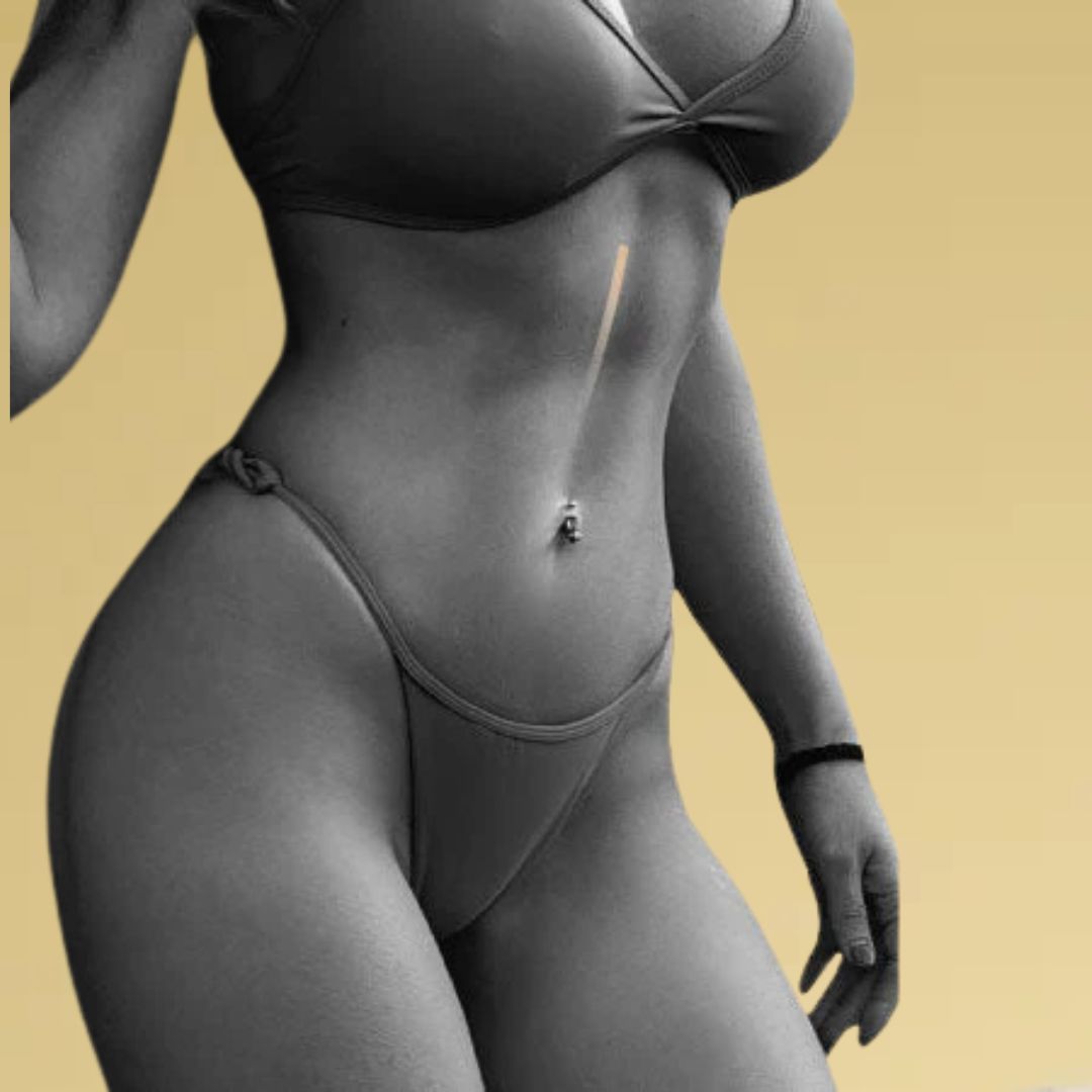 Torso de cuerpo de mujer con Mesoterapia Corporal