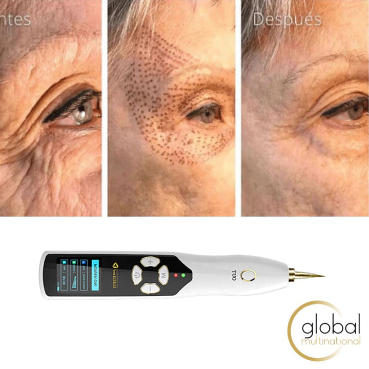 Equipo Fibroblast Ozone Pen Plasma Antienvejecimiento + Synergy Heal Loción de Reepetilización